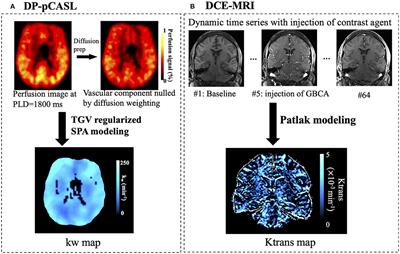 Comparison Between Blood-Brain Barrier Water Exchange Rate and Permeability to Gadolinium-Based Contrast Agent in an Elderly Cohort